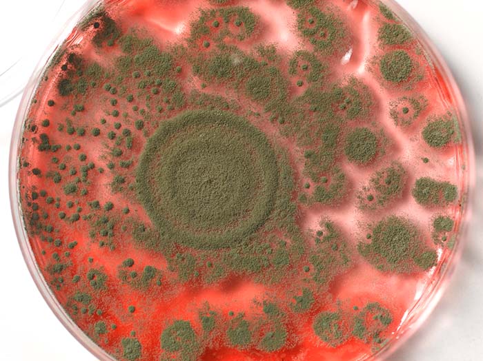 Placa de Petri con cultivo de microogranismos