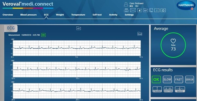 EKG Aufzeichnung