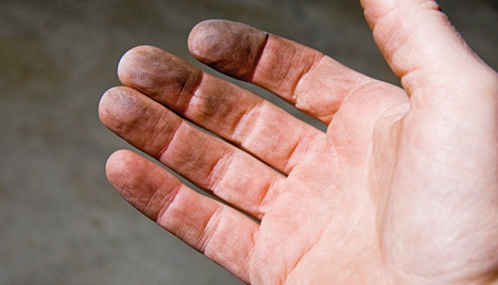 Schmutzige Hand