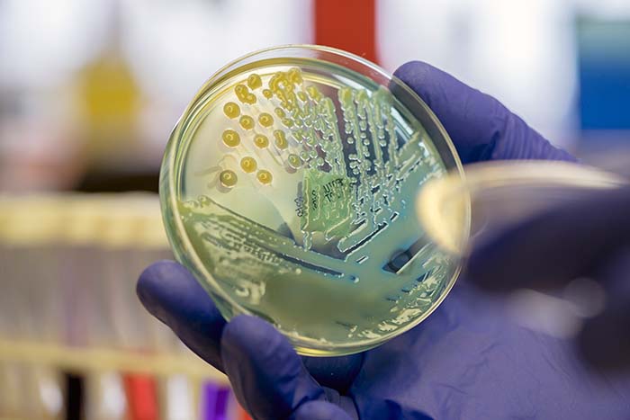 Placa de petri con cultivo de microorganismos