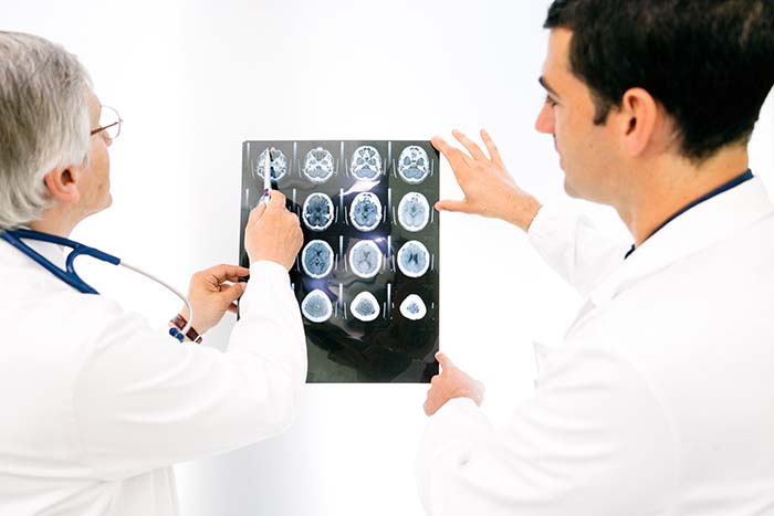 Médicos observando un TAC cerebral